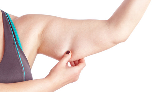 Arm Liposuction in delhi