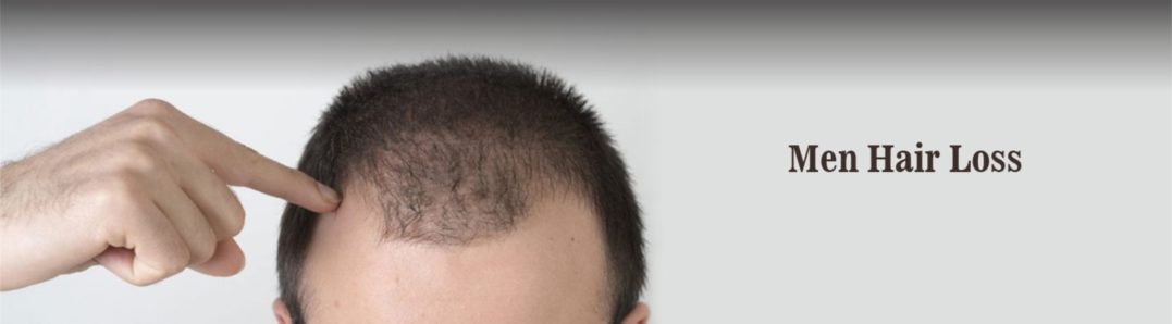 What is Scalp Micropigmentation?